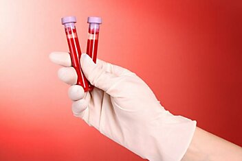 Читать и понимать: Биохимический анализ крови — норма и расшифровка