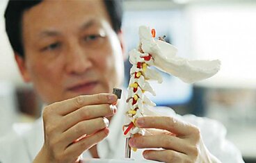 Медики из Пекинского университета впервые имплантировали человеку напечатанный на 3D-принтере позвонок