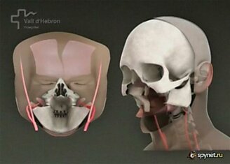 Операция по частичной пересадке лица (11 фото)