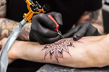 The Pros and Cons of Tattoo Removal