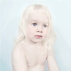 Люди-альбиносы в фотопроекте Сане Де Вайлд