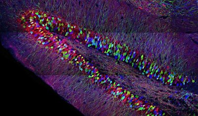 Мозг чистит память с помощью новых нервных клеток