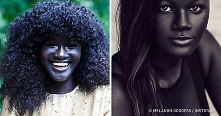 Эта девушка покорила интернет уникальным цветом своей кожи