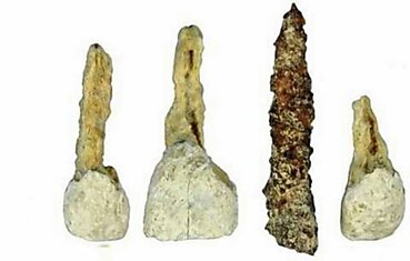 Археологи нашли старейший зубной имплантат в Европе