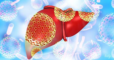 Иммунитет в опасности: гепатит С