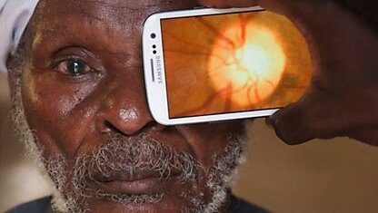 При помощи смартфона можно проверить зрение