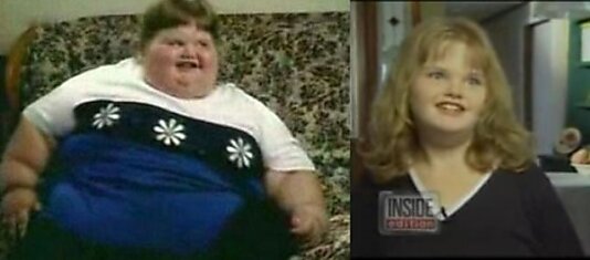 История толстого ребенка