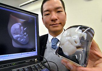 Профессии будущего: 3D печать в медицине