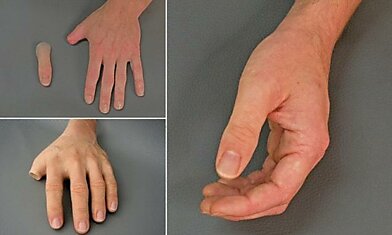 Дизайнеры из Германии создали уникальные  протезы  пальцев