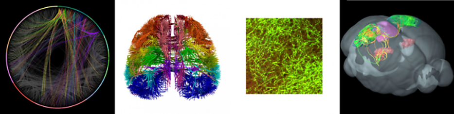 Ученые получили новые снимки работы нейронов мозга