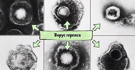 Вирус герпеса – не просто легкая кожная болезнь. На самом деле он опаснее, чем ты думал!