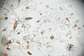 Как выглядит капля морской воды под микроскопом или микрозоопарк