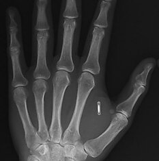 Как я имплантировал RFID себе в руку, а потом еще NFC. Часть 1