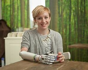 Новая модель бионической руки Bebionic Small