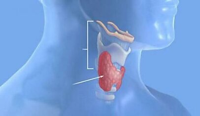 Щитовидная железа: психосоматика проблемы
