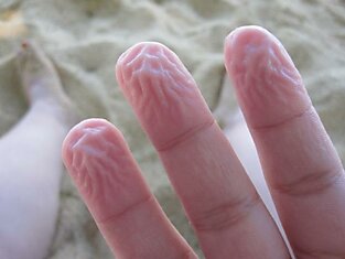 Человеческие пальцы сморщиваются при длительном контакте с водой