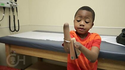 Восьмилетний Зион Харви стал первым ребёнком, которому пересадили кисти обеих рук