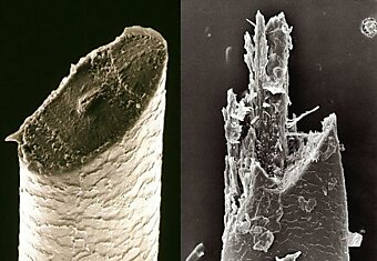 Почему снимки двух одинаковых человеческих волосков под микроскопом выглядят по разному?