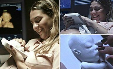 Распечатанное на 3D-принтере УЗИ помогло слепой маме увидеть своего ребенка до рождения.