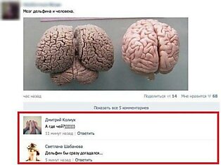 Мозг дельфина и мозг человека