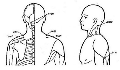 Точки для снятия боли в области плечевого сустава