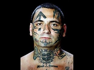 Брайон Виднер, удаление нео-нацистских татуировок с лица
