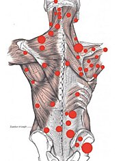 Как избавиться от боли в спине — советы остеопата