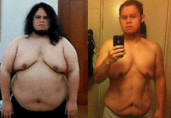 До и после невероятного похудения