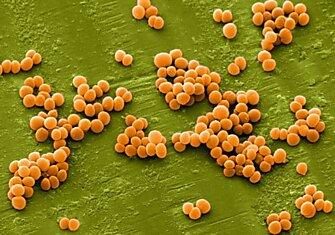 Вот что нужно знать о золотистом стафилококке: домашние средства, способные побороть инфекцию.