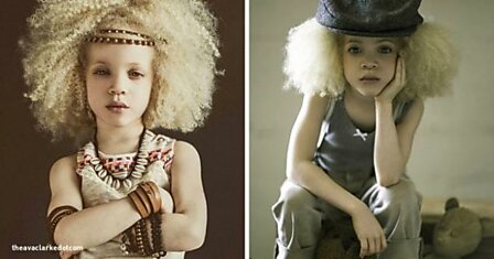 8-летняя девочка-альбинос Ава Кларк — новая звезда мира моды