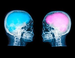 Биологи из Чикаго утверждают, что разница между мужским и женским мозгом сильно преувеличена