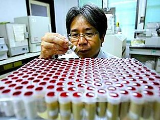 Японские учёные превратили клетки кожи в нервные без пересадки генов