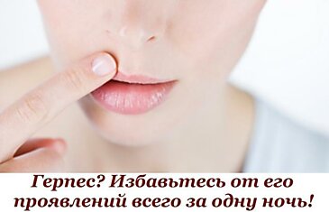 Герпес? Избавьтесь от его проявлений всего за одну ночь!