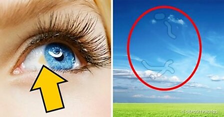 12 вещей, которые глаза могут рассказать о вашем здоровье