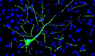 Пересаженные нервные клетки встроились в мозг