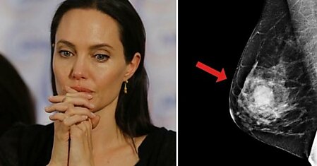 Анджелина Джоли — худший из примеров! Вот кому на самом деле стоит провериться у генетика…