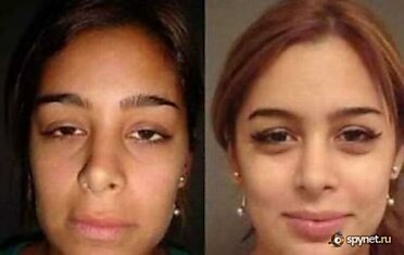 Larissa Riquelme до и после пластической операции (9 фото)