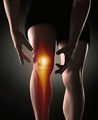 Боль в коленных чашечках приводит к артриту